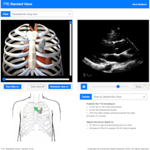 U of T TTE Simulator
